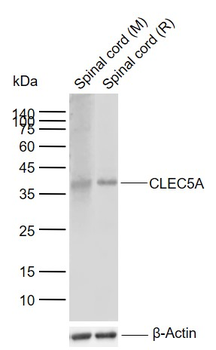 CLEC5A Rabbit Polyclonal Antibody
