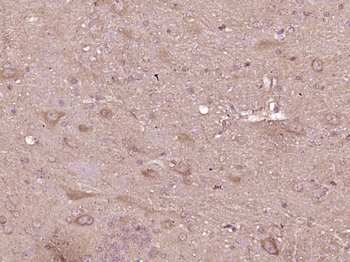 COL4A3BP Rabbit Polyclonal Antibody