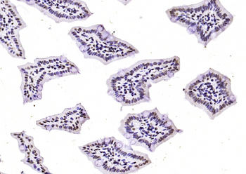 Cofilin Rabbit Polyclonal Antibody