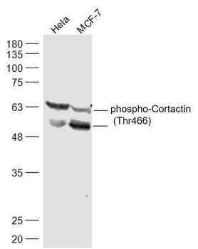 Phospho-Cortactin (Thr466) Rabbit Polyclonal Antibody