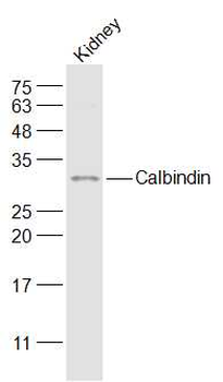CALB1 Rabbit Polyclonal Antibody
