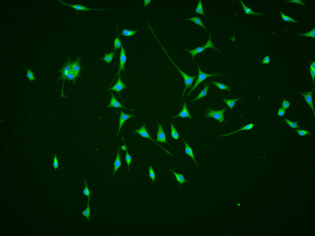 CALB1 Rabbit Polyclonal Antibody