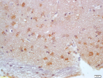 CALB1 Rabbit Polyclonal Antibody