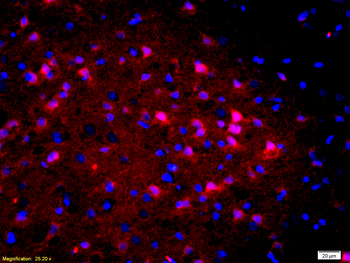 CALB1 Rabbit Polyclonal Antibody