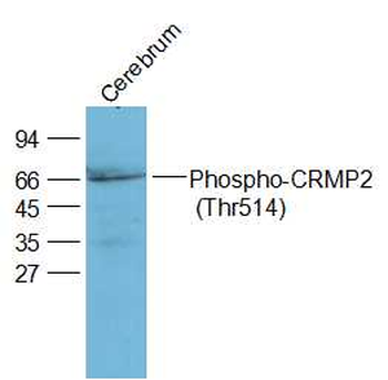 Phospho-CRMP2 (Thr514) Rabbit Polyclonal Antibody