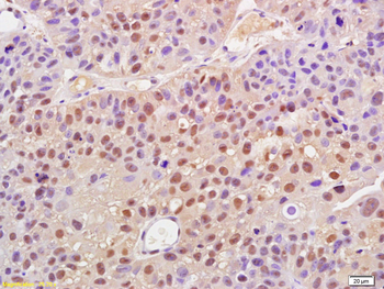 Phospho-Cyclin B1 (Ser147) Rabbit Polyclonal Antibody