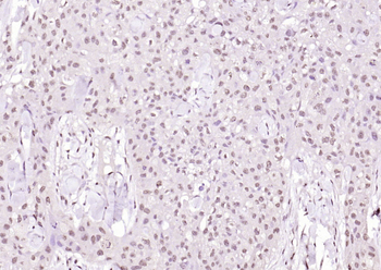 Phospho-Cyclin B1 (Ser126) Rabbit Polyclonal Antibody