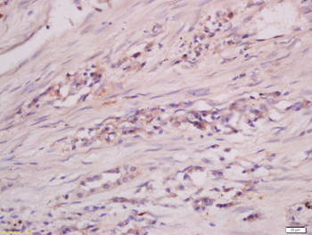 CYP46 Rabbit Polyclonal Antibody