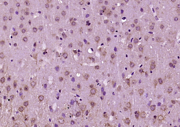 CYP46 Rabbit Polyclonal Antibody