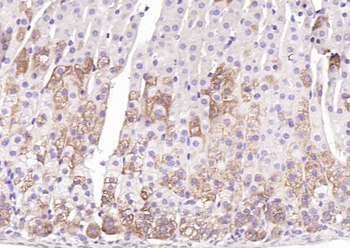 CYP11A1 Rabbit Polyclonal Antibody