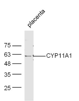 CYP11A1 Rabbit Polyclonal Antibody