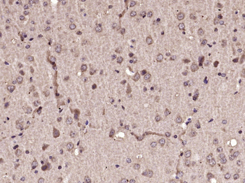 CYP24A1 Rabbit Polyclonal Antibody