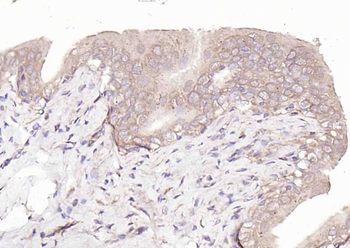 CYP24A1 Rabbit Polyclonal Antibody