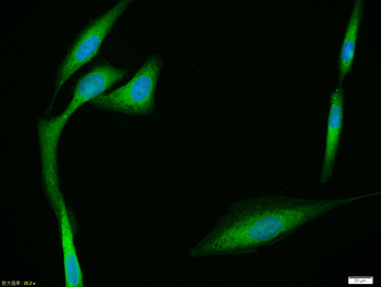 CYP24A1 Rabbit Polyclonal Antibody