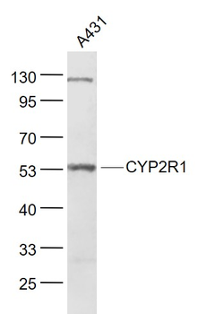 CYP2R1 Rabbit Polyclonal Antibody