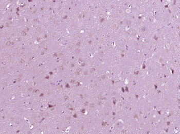 RET Rabbit Polyclonal Antibody