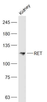 RET Rabbit Polyclonal Antibody