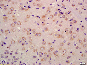 RET Rabbit Polyclonal Antibody