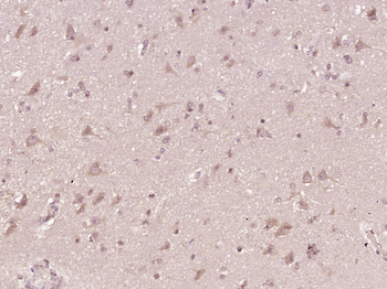 Phospho-Ret (Tyr905) Rabbit Polyclonal Antibody