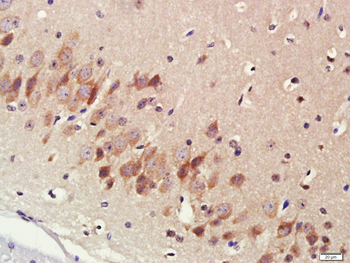 Cytochrome P450 17A1 Rabbit Polyclonal Antibody