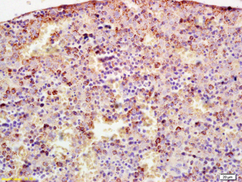 Cytochrome P450 17A1 Rabbit Polyclonal Antibody