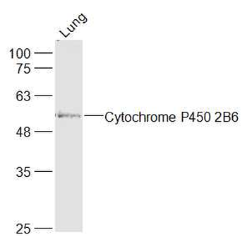 Cytochrome P450 2B6 Rabbit Polyclonal Antibody