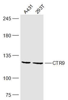 CTR9 Rabbit Polyclonal Antibody