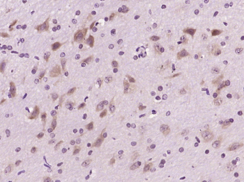 Phospho-Dab1 (Tyr220) Rabbit Polyclonal Antibody