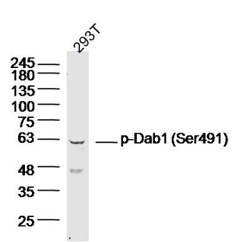 Phospho-Dab1 (Ser491) Rabbit Polyclonal Antibody