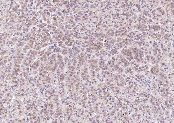 BRINP1 Rabbit Polyclonal Antibody