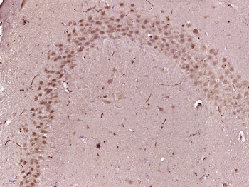 BRINP1 Rabbit Polyclonal Antibody