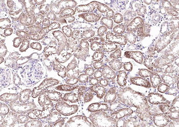 BRINP1 Rabbit Polyclonal Antibody