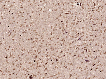 BRINP1 Rabbit Polyclonal Antibody