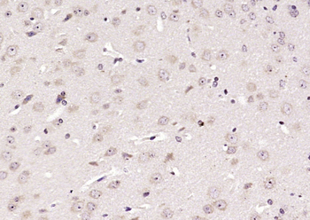 Phospho-DARPP32 (Thr75) Rabbit Polyclonal Antibody