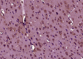 Phospho-Doublecortin (Ser47) Rabbit Polyclonal Antibody
