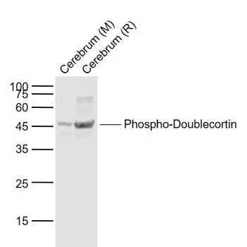 Phospho-Doublecortin (Ser47) Rabbit Polyclonal Antibody