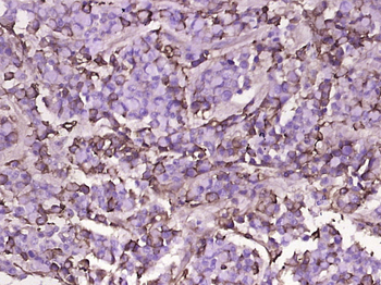 D-DIMER Rabbit Polyclonal Antibody