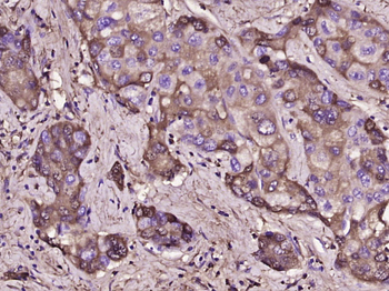 D-DIMER Rabbit Polyclonal Antibody