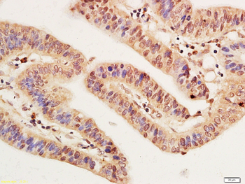 EZH2 Rabbit Polyclonal Antibody