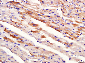 DMT1 Rabbit Polyclonal Antibody