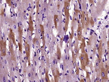DMT1 Rabbit Polyclonal Antibody
