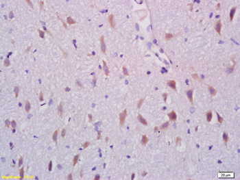 ARHGAP17 Rabbit Polyclonal Antibody