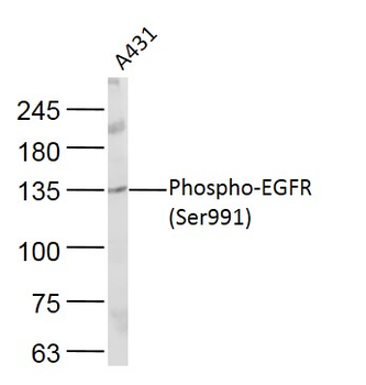 Phospho-EGFR (Ser991) Rabbit Polyclonal Antibody