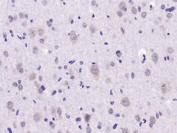 EIF2S1 Rabbit Polyclonal Antibody