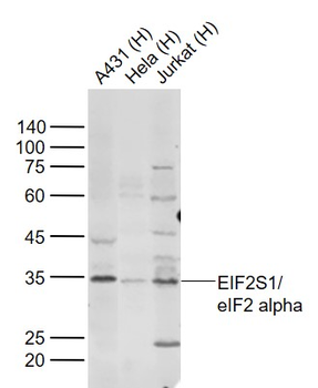 EIF2S1 Rabbit Polyclonal Antibody