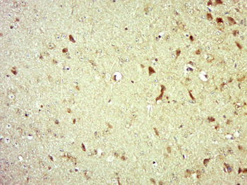 EIF3A Rabbit Polyclonal Antibody
