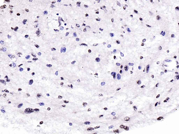 EIF4G Rabbit Polyclonal Antibody