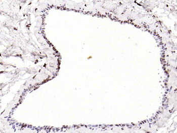 EIF4G Rabbit Polyclonal Antibody