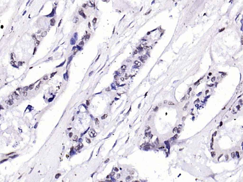 EIF4G Rabbit Polyclonal Antibody
