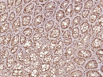 EIF4G Rabbit Polyclonal Antibody